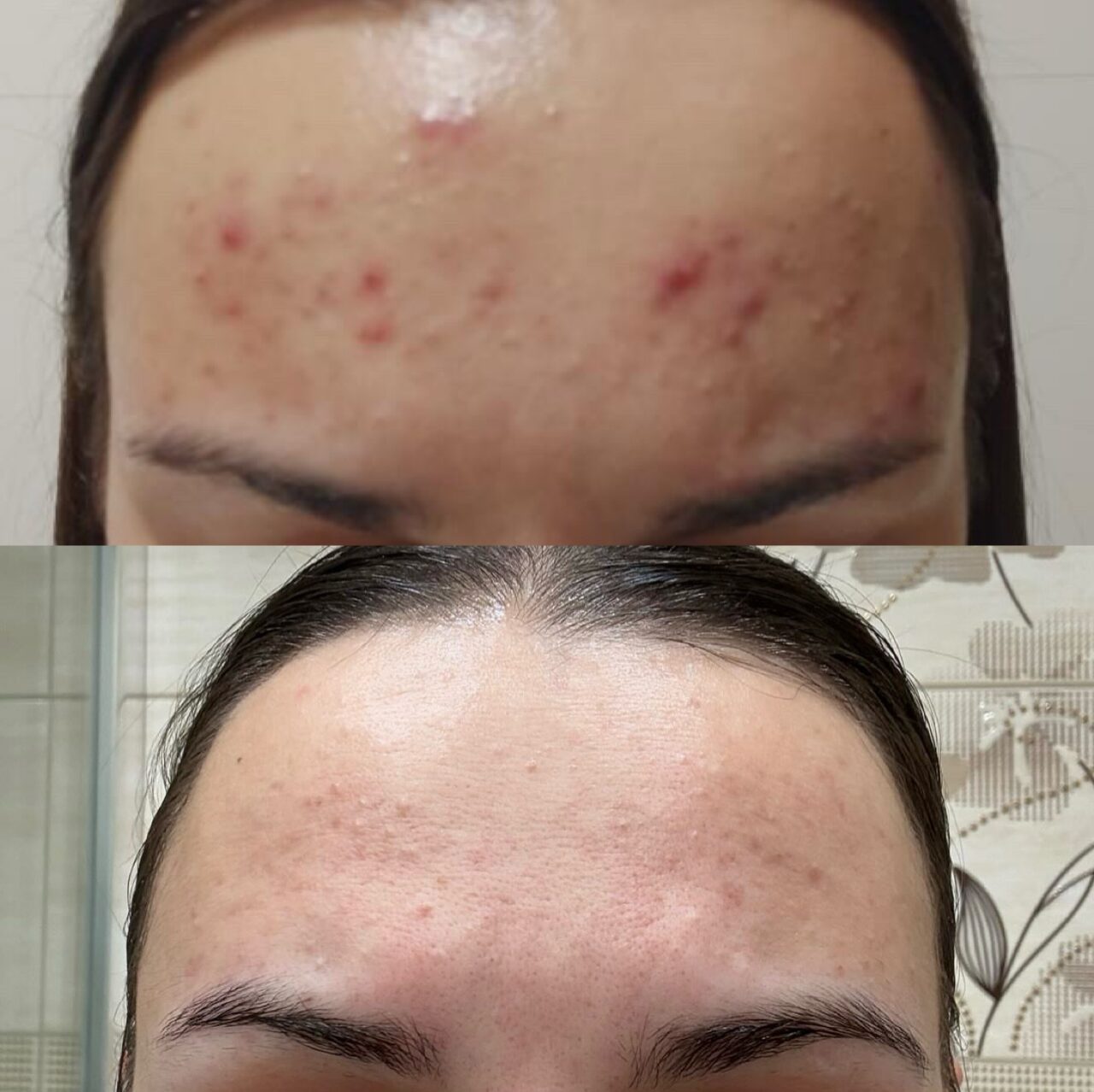 Efekt zabiegu estetyki twarzy – Turowska Clinic Kleczew