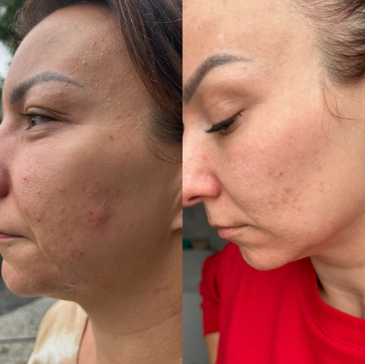 Efekt makijażu permanentnego brwi – Turowska Clinic Kleczew