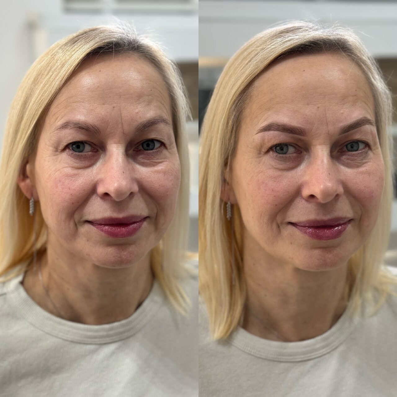 Efekt modelowania sylwetki – Turowska Clinic Kleczew