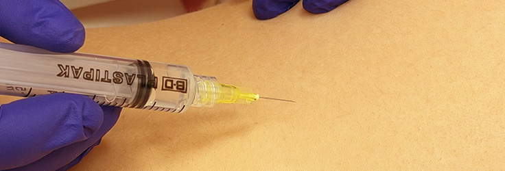 Lipoliza iniekcyjna – modelowanie sylwetki, Turowska Clinic Kleczew